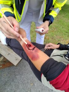 blessure